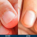 anti_nail_biting_polish_protective_coat_ortoprime_uk