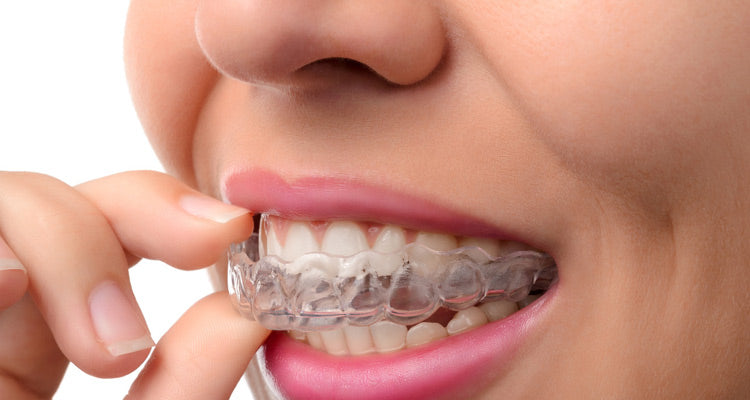 bruxism-night-guard-dental-aid-ortoprime-uk