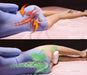 ergonomic-knee-pillow-side-sleeping-leg-separator-ortoprime-uk