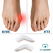 hallux-valgus-correction-toe-kit-ortoprime-uk