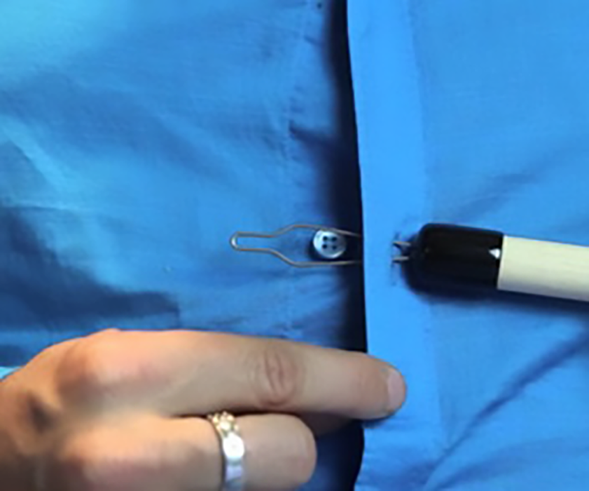 reach-button-fastener-zip-lift-hook-ortoprime-uk