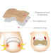 restorative_nail_patches_for_brittle_toenails_ortoprime_uk