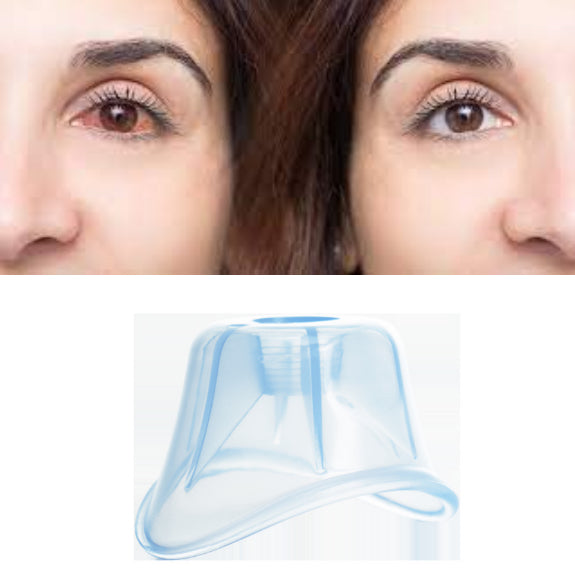 steady-eye-dropper-for-sensitive-eyes-ortoprime-uk
